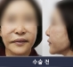 볼 지방이시 제…