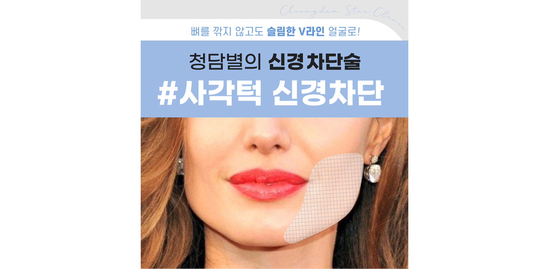 사각턱1